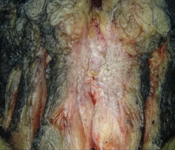 Description of the image